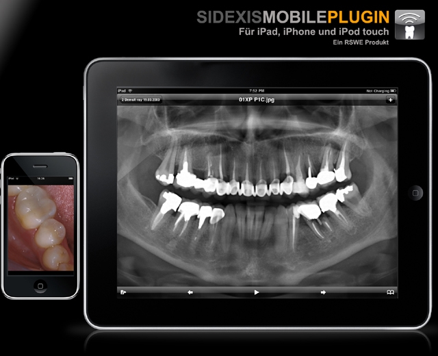 RSWE stellt ein Update des SidexisMobilePlugins mit nativer Unterstützung der neuen Gerätefunktionen vor. Das brilliante iPad® Display mit LED Hintergrundbeleuchtung eröffnet neue Wege in der Patientenkommunikation.